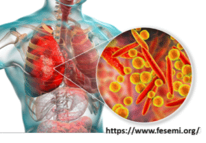 Mycoplasma pneumoniae | Mitlab